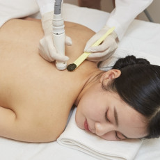 더록시 청담점에서 등 트러블 강필 체험해보세요!