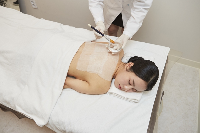 [서울/청담] 더록시 청담점에서 등 트러블 강필 체험해보세요!