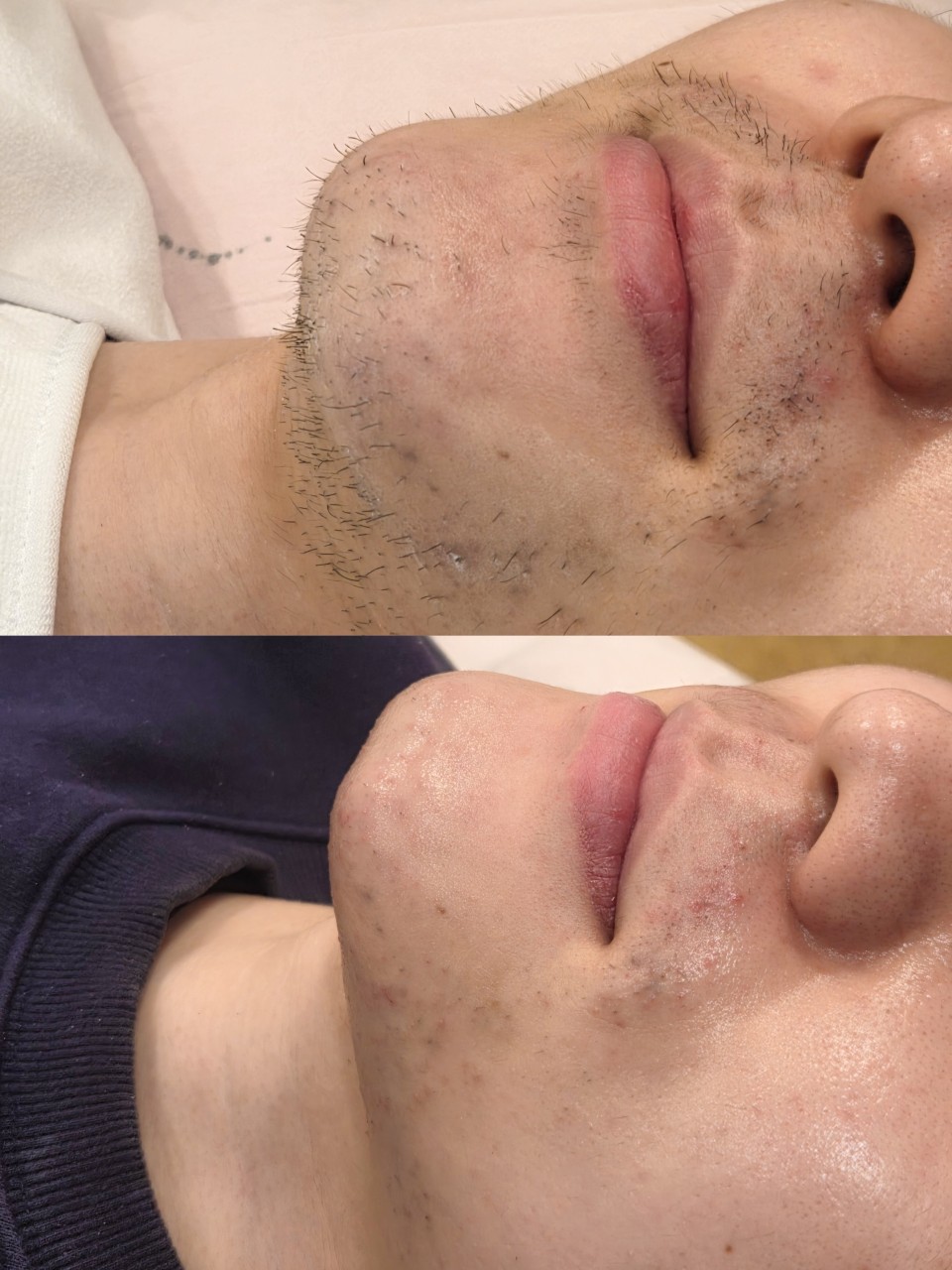 [충북/청주] 비엘르의 고품격 슈가링 왁싱을 경험해보세요!