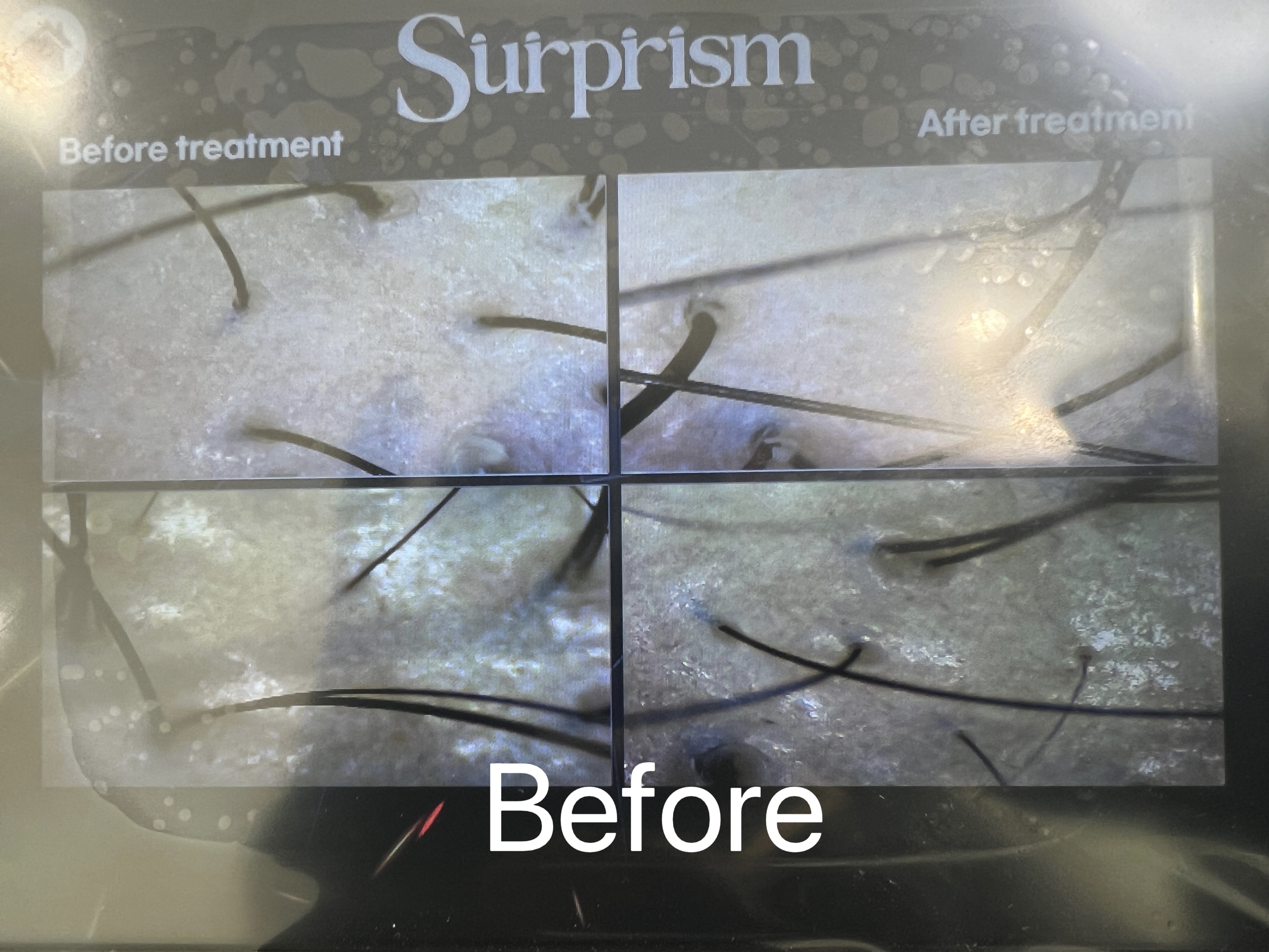 [제주] 카린뷰티랩에서 에어톡스 두피생장 받아보세요♥