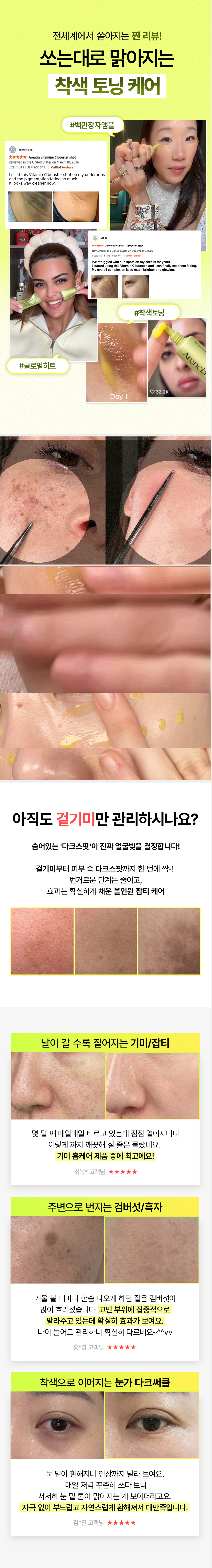 [블로그] 비타민C 부스터샷으로 기미 관리 하세요!