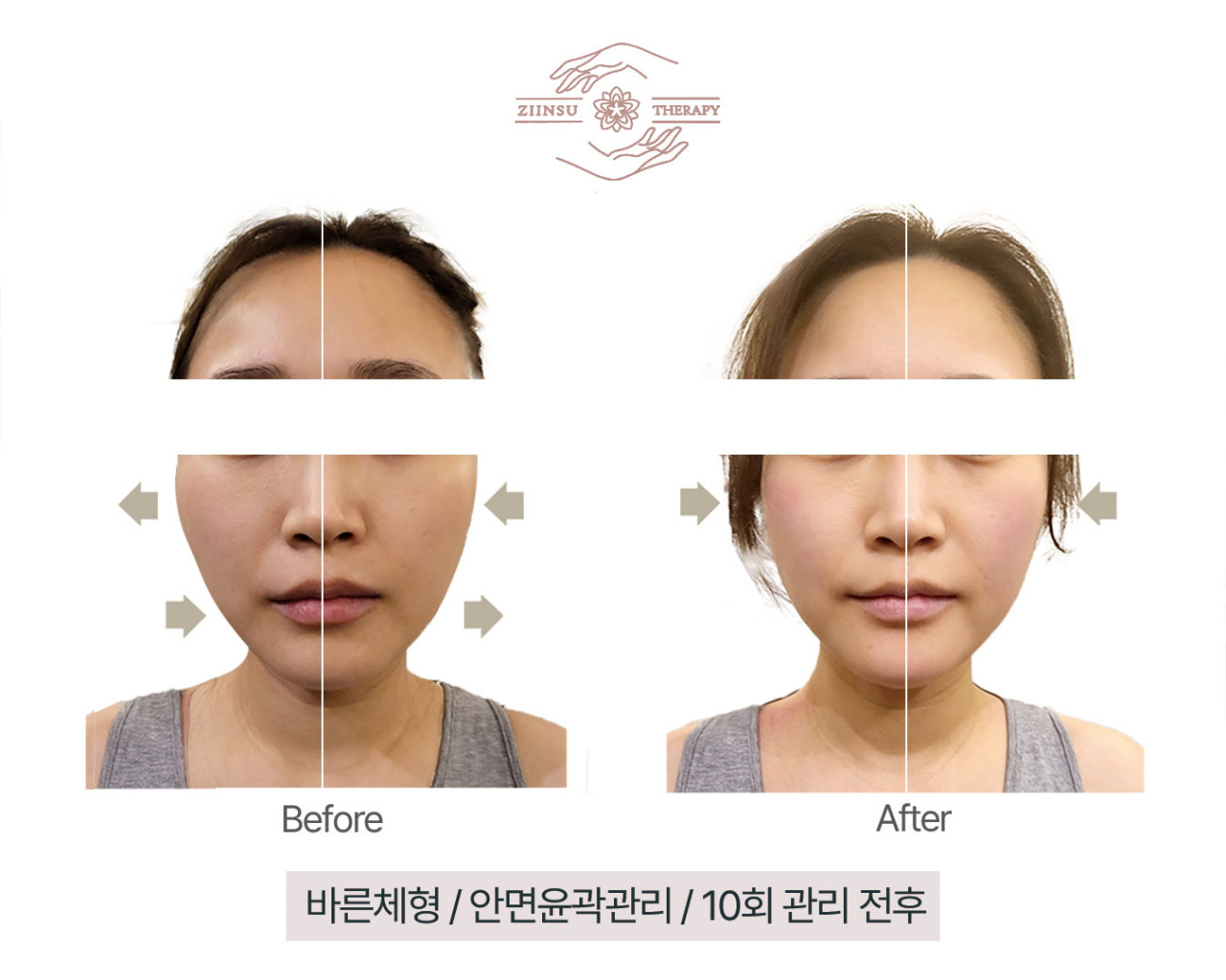 [경기/남양주] 다산에서 윤곽,체형관리 받고 가세요~!